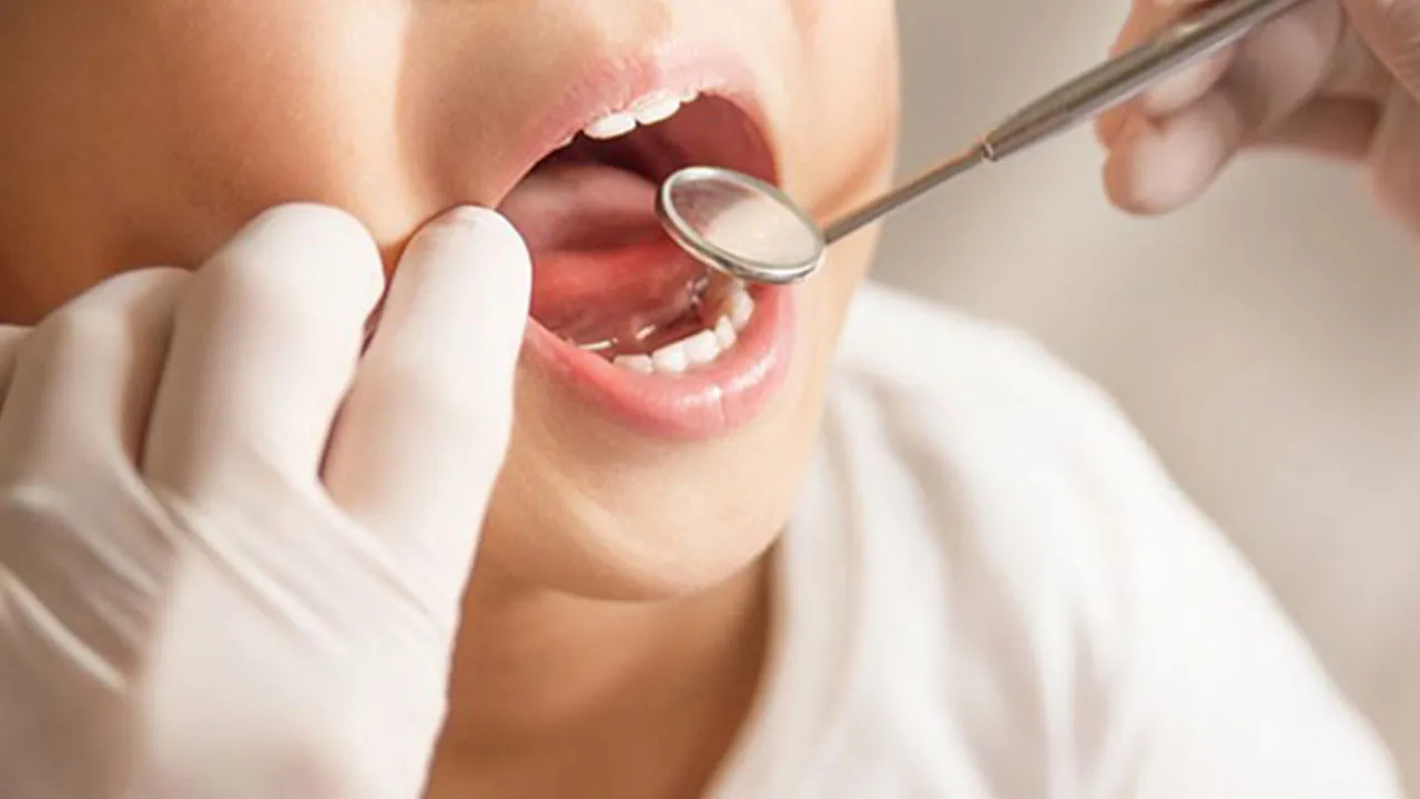 Diş çürüğü sinsi bir tehdit! Tüm vücudu tehlikeye atabilir