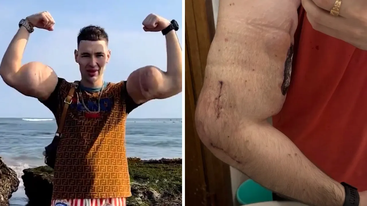 Bu enjeksiyon hayatını kararttı! 'Rus Temel Reis' ölümle karşı karşıya