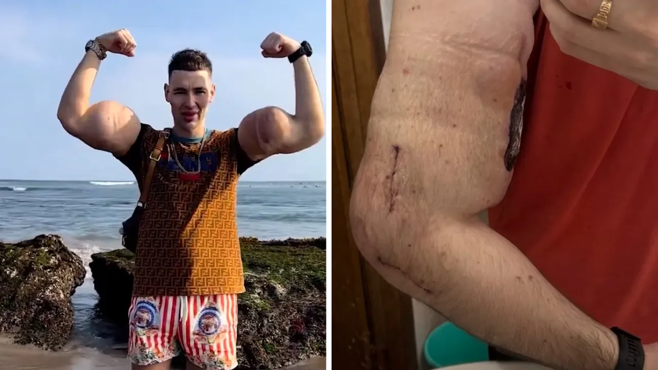 Kimyasallar kollarını çürüttü! 'Rus Temel Reis' ölümle karşı karşıya 