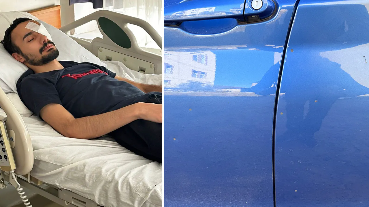 Tartıştığı damadını gözünden vurdu