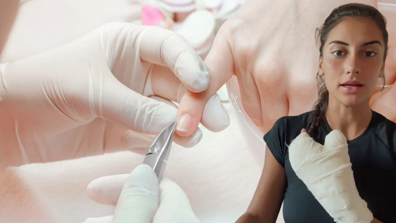 Yaptırdığı manikür hayatını kararttı! 18 günde 6 operasyon geçirdi