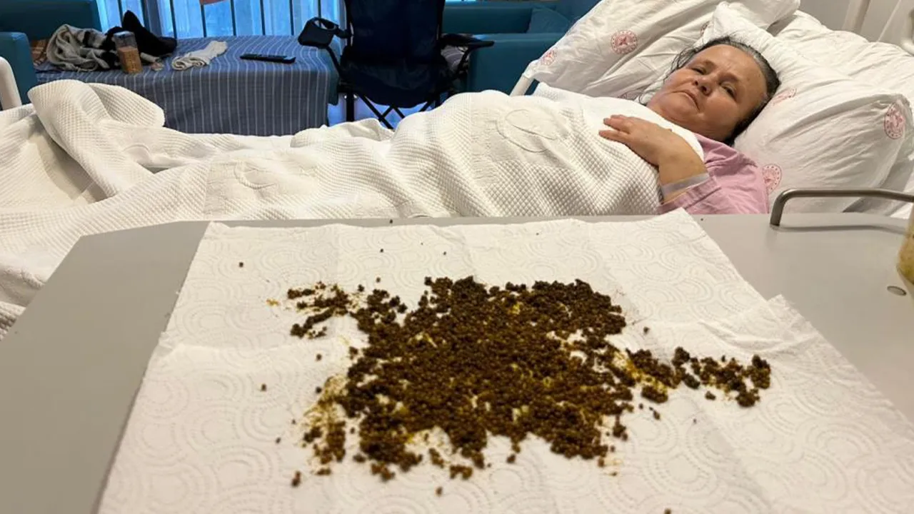 Kendisi bile şaşırdı! Safra kesesinden binlerce taş çıkarıldı