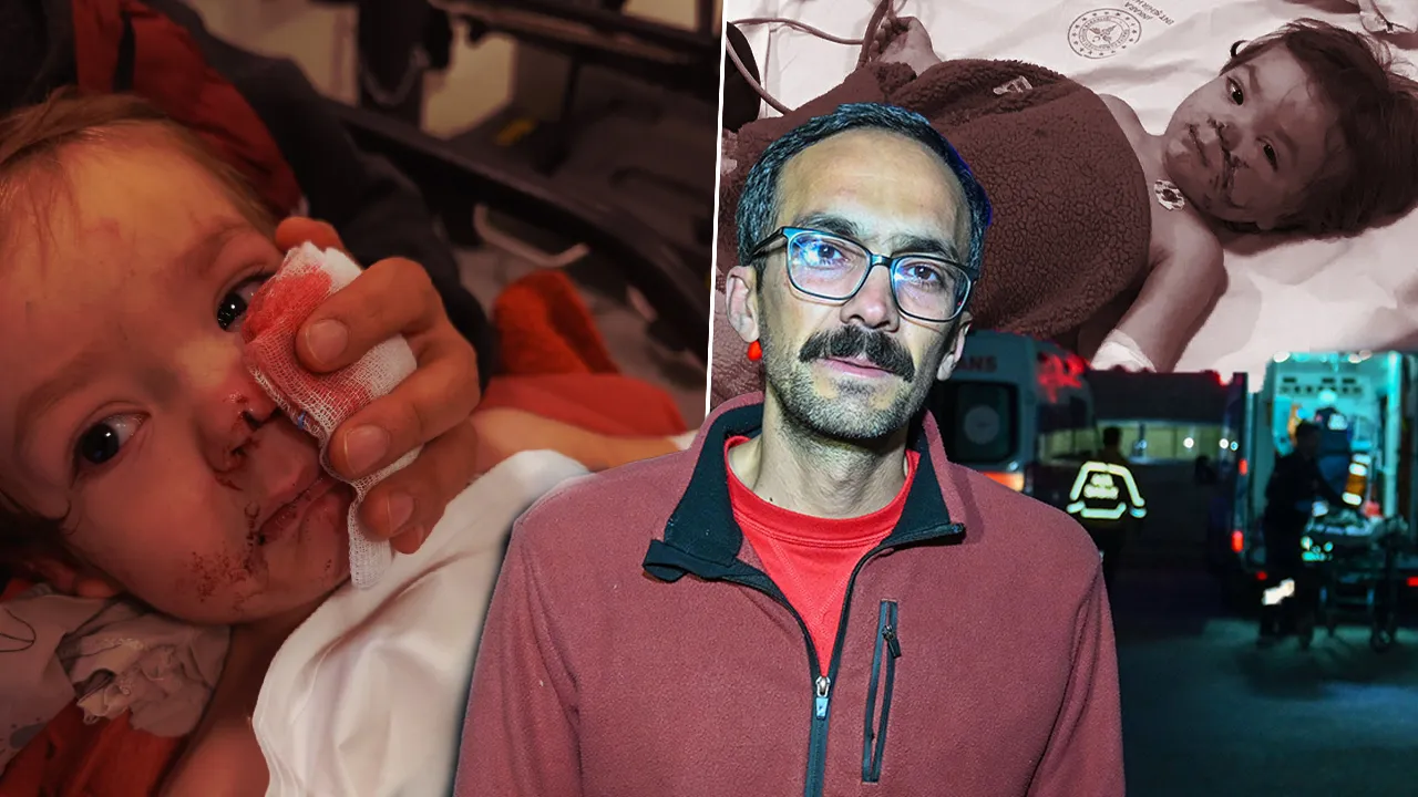 BEBEĞİN YÜZÜNÜ PARÇALADI