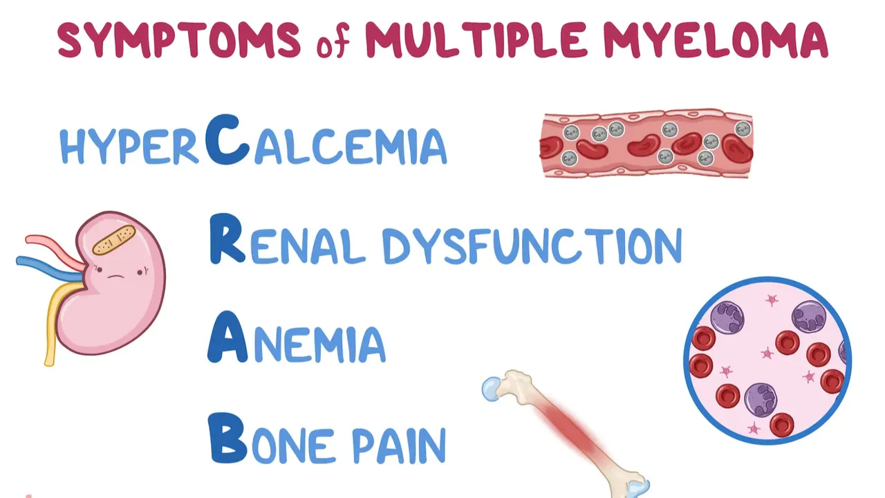 Bir yıl ömür biçilen hastalar tamamen iyileşti! Multiple Miyelom kanseri için en iyi tedavi yöntemi keşfedildi