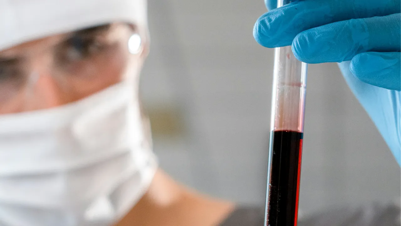 Bir yıl ömür biçilen hastalar tamamen iyileşti! Multiple Miyelom kanseri için en iyi tedavi yöntemi keşfedildi