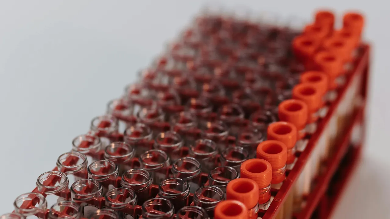 Bir yıl ömür biçilen hastalar tamamen iyileşti! Multiple Miyelom kanseri için en iyi tedavi yöntemi keşfedildi