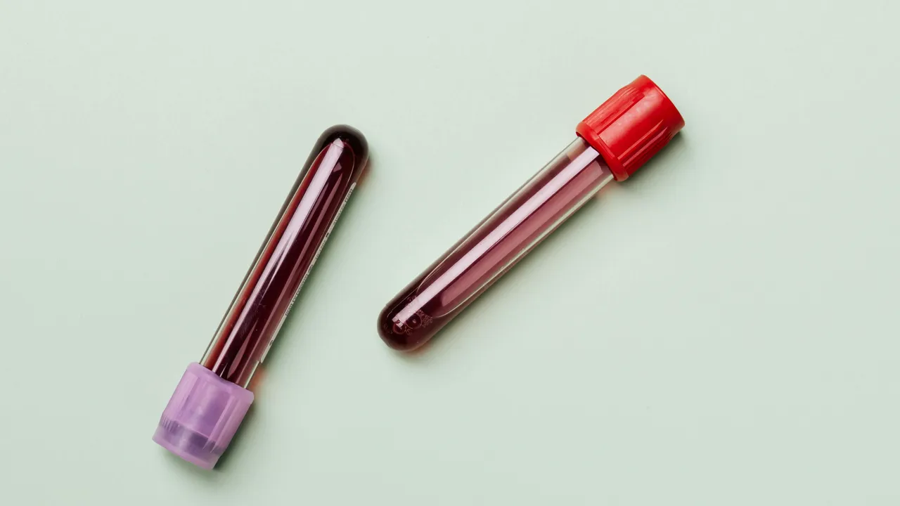 Bir yıl ömür biçilen hastalar tamamen iyileşti! Multiple Miyelom kanseri için en iyi tedavi yöntemi keşfedildi