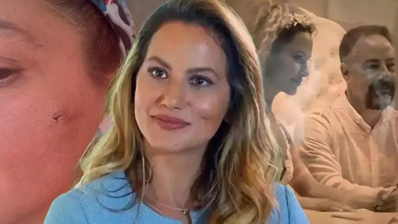 Şiddet iddiasıyla gündeme gelmişti: Yıldız Asyalı'dan korkutan paylaşım!