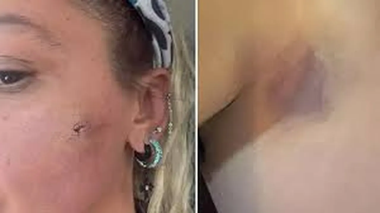 Şiddet iddiasıyla gündeme gelmişti: Yıldız Asyalı'dan korkutan paylaşım!