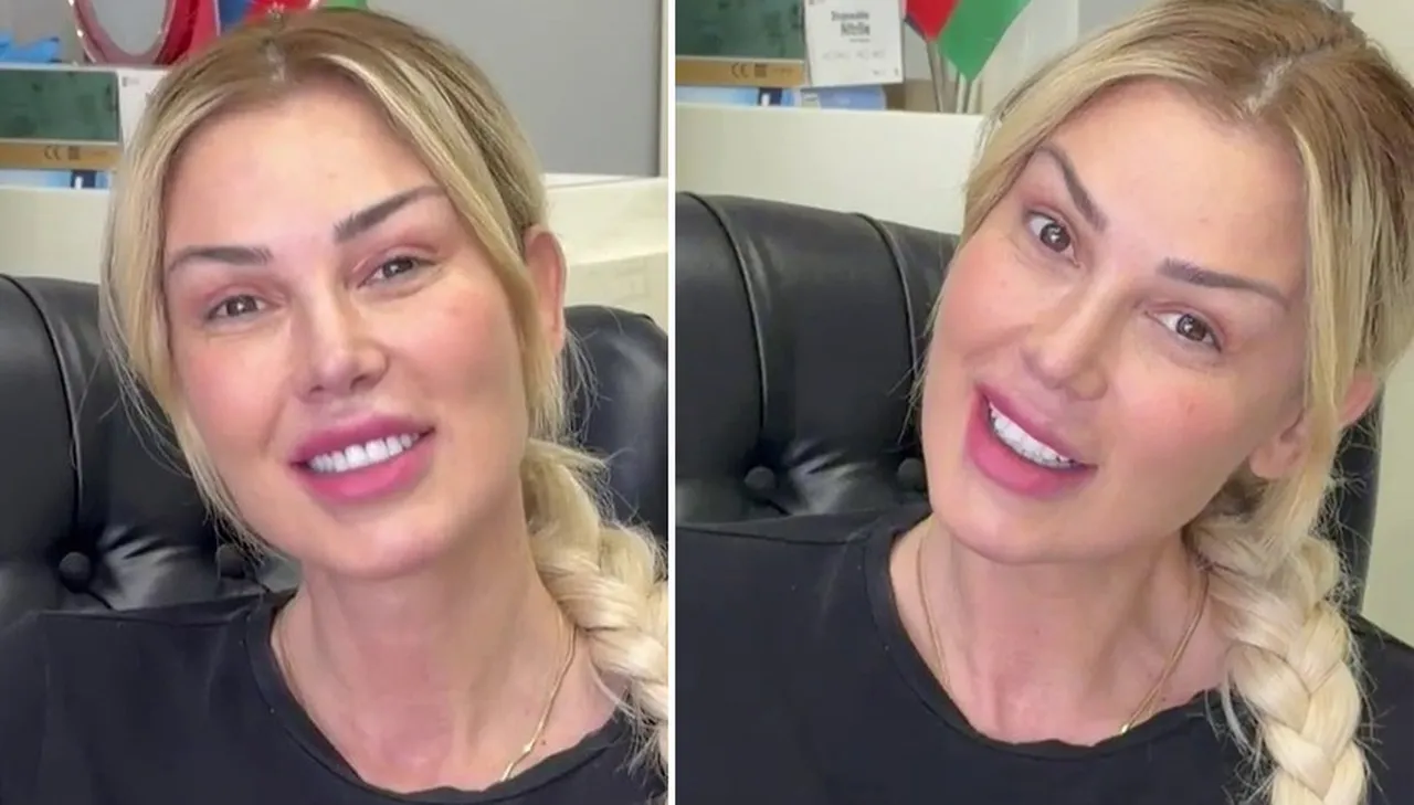 Yüz gençleştirme operasyonu geçirmişti: 8 ay sonra makyajsız görüntüsü paylaşıldı