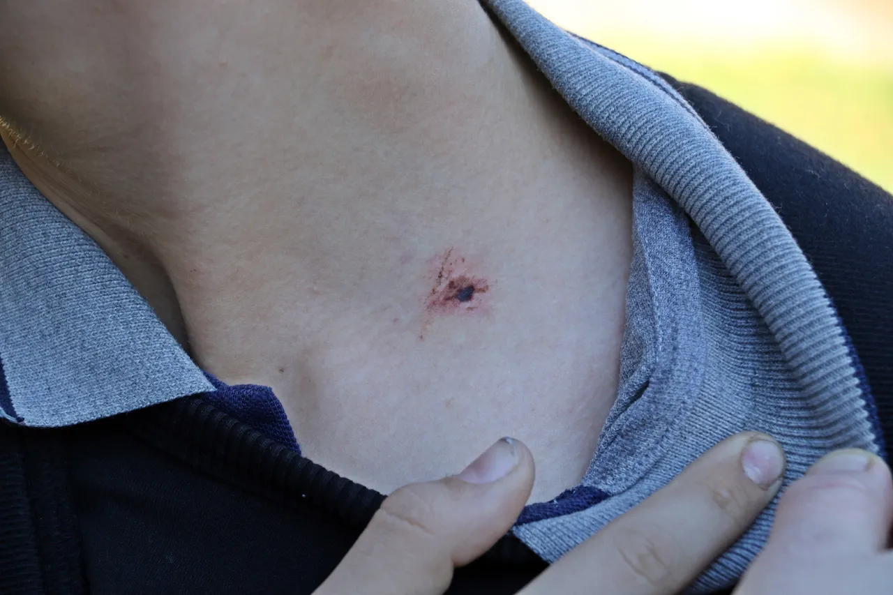 Teneffüs kabusa döndü! Akran zorbalığına uğrayan ortaokul öğrencisi ölümden döndü