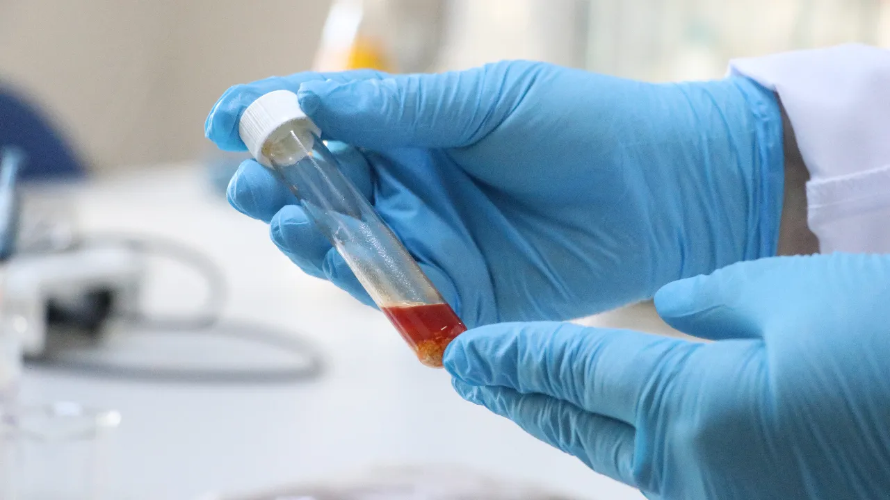 Üzüm posasından yüksek değerli 'tek hücre yağı' üretildi