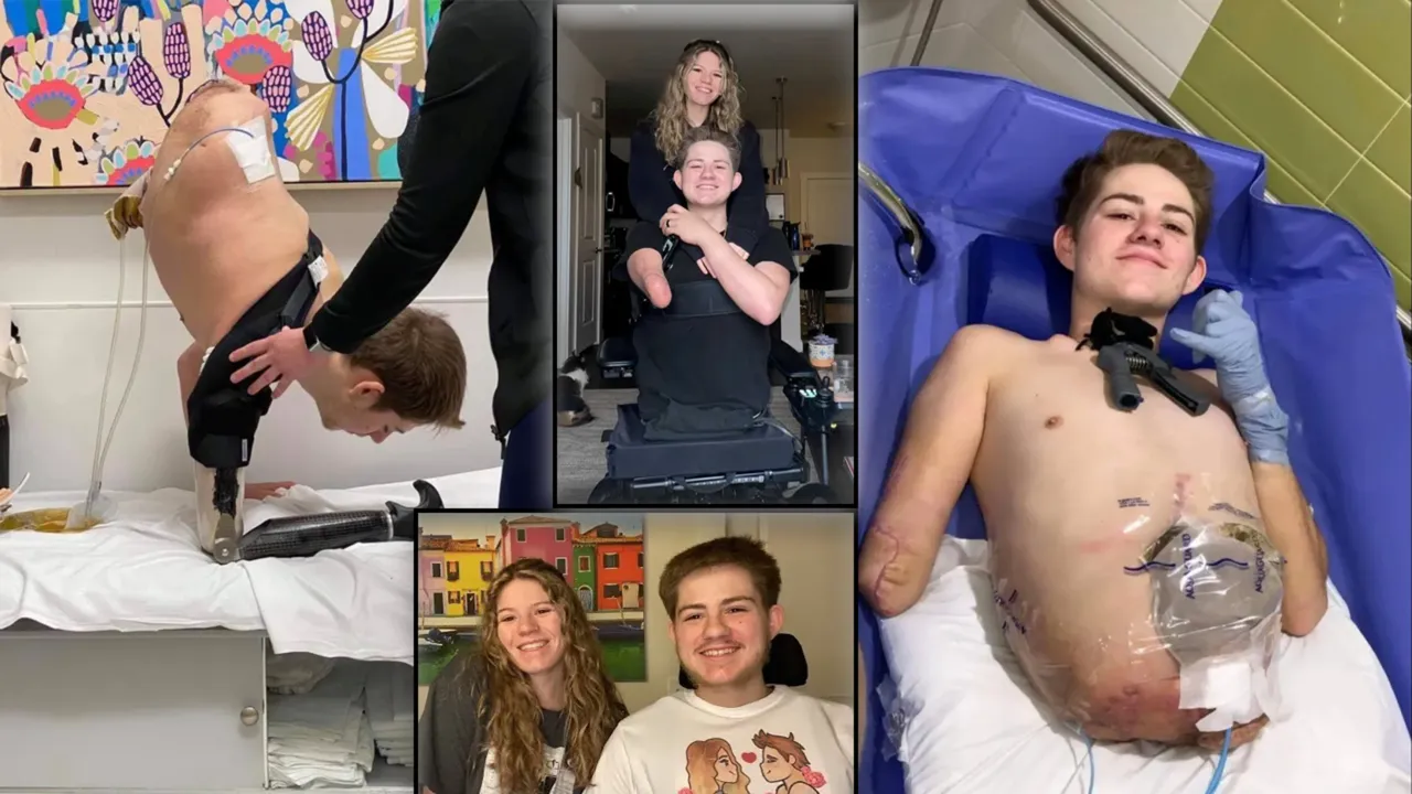 Forklift kazasında vücudunun yarısını kaybetti: Sadece başım kalsa bile yaşamak istedim