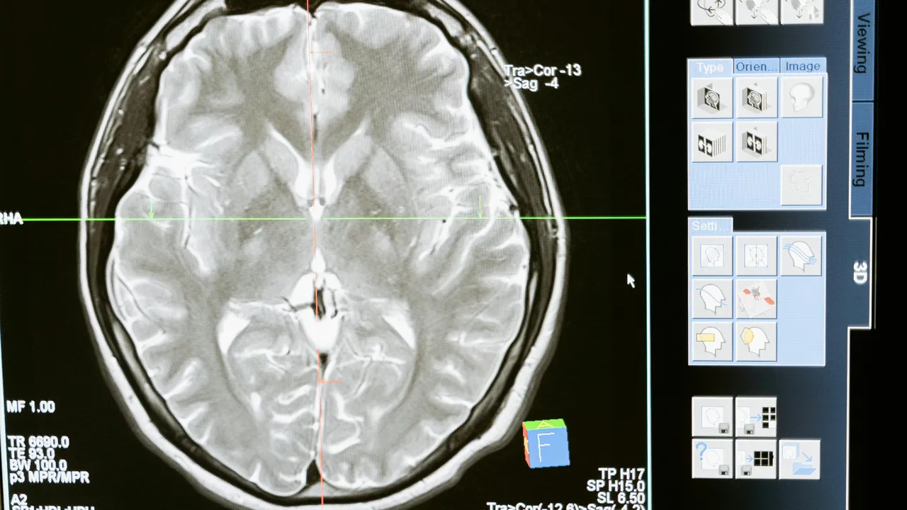 Beyninizi 8 yaş gençleştirecek dört alışkanlık: Bilim insanları açıkladı!