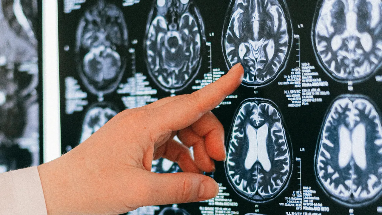 Beyninizi 8 yaş gençleştirecek dört alışkanlık: Bilim insanları açıkladı!