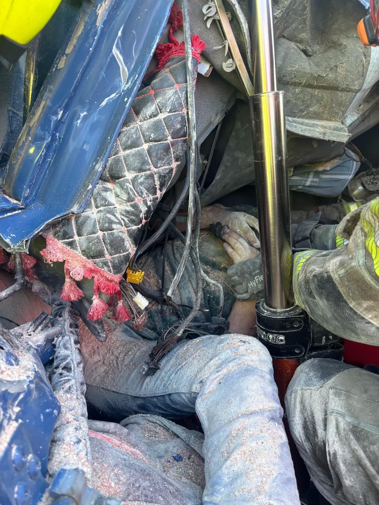 Yaralı sürücünün kaburgası kırıldı