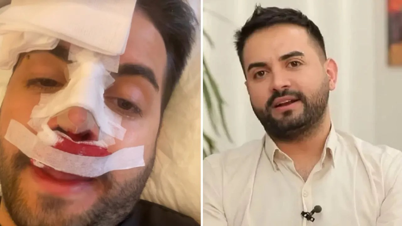 Kadir Ezildi’nin sargılı paylaşımı korkuttu! Gerçek sonradan ortaya çıktı