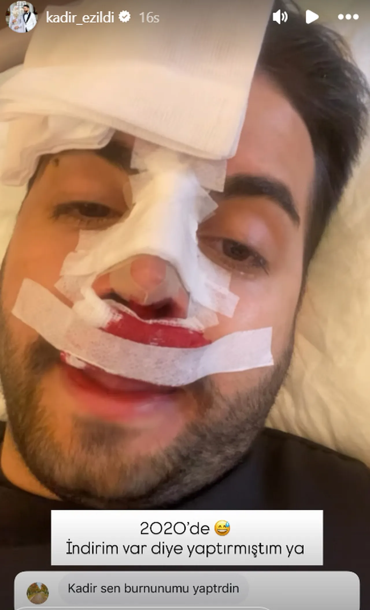 Kadir Ezildi’nin sargılı paylaşımı korkuttu! Gerçek sonradan ortaya çıktı