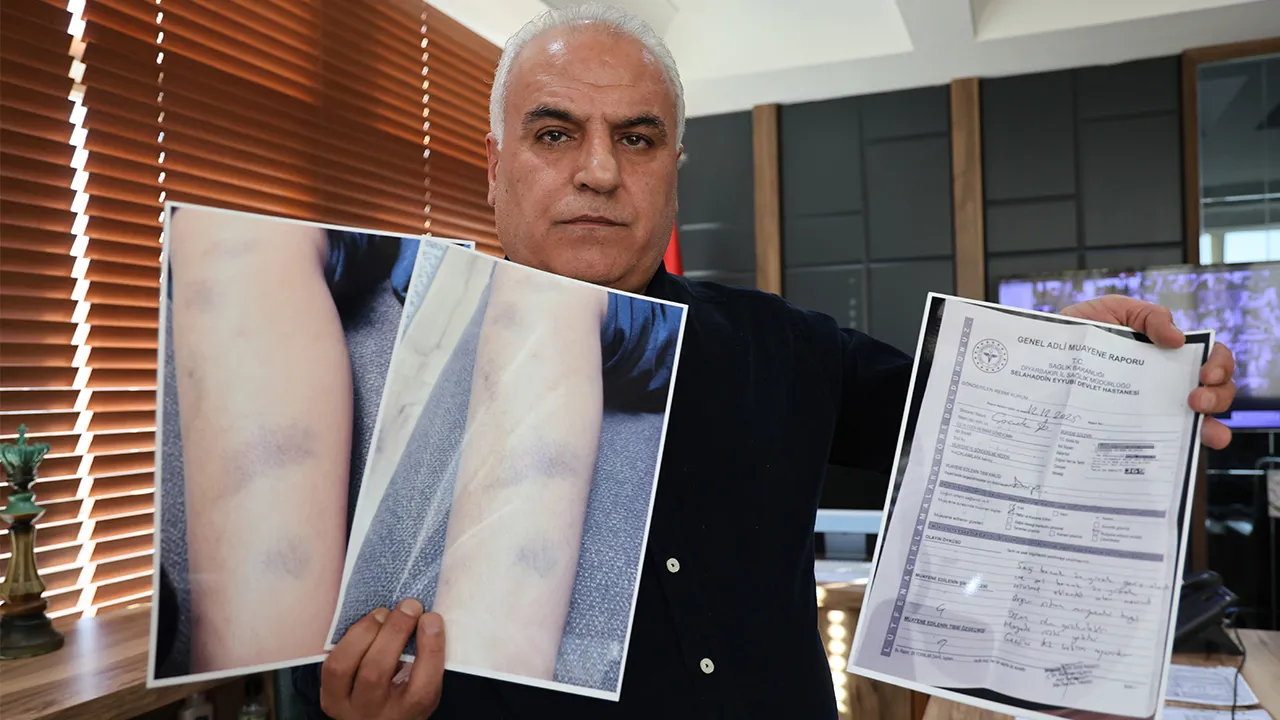 Özel okulda darp iddiası! Ailenin sözleri başka, okul yönetiminin bambaşka