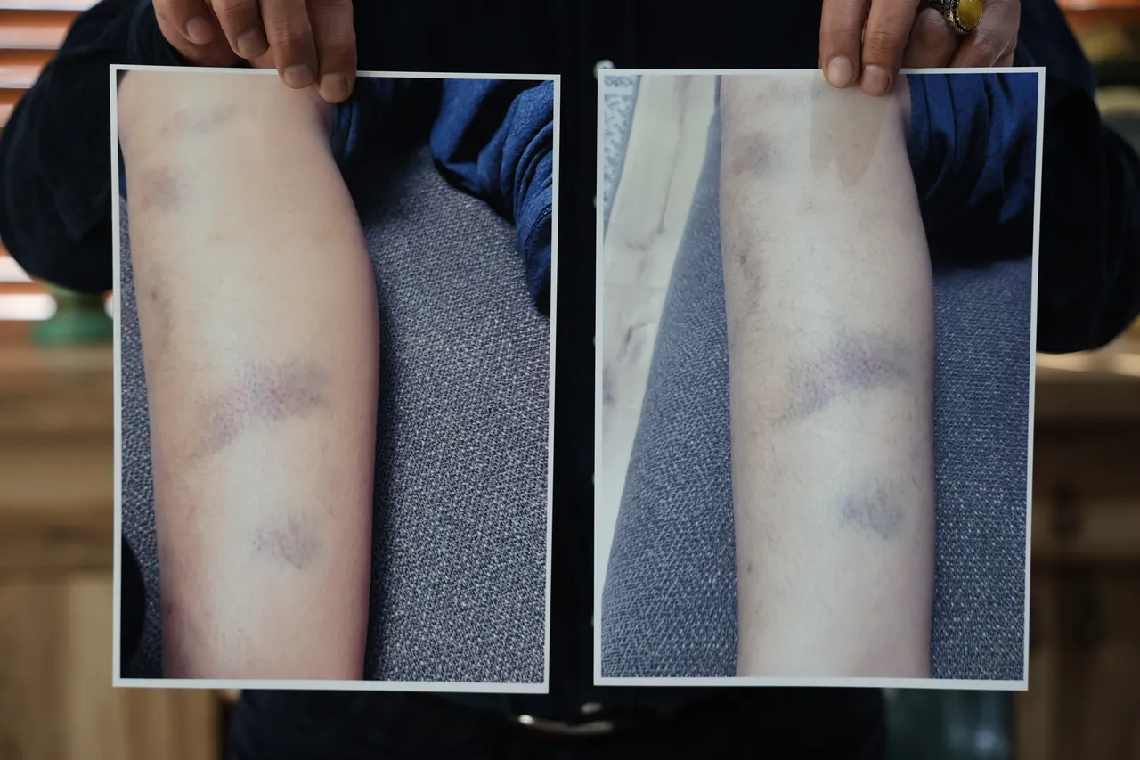 Özel okulda darp iddiası! Ailenin sözleri başka, okul yönetiminin bambaşka