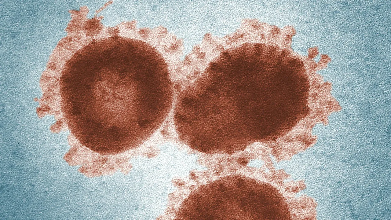 Türkiye'de de görülmüştü: H3N2 virüsü için DSÖ'den alarm: Önemli mutasyonlar taşıyor