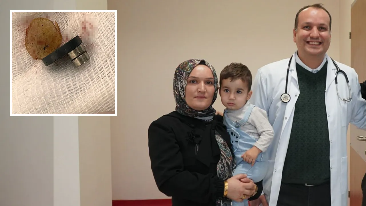 Mıknatıs yutan bebeğin bağırsağı delindi