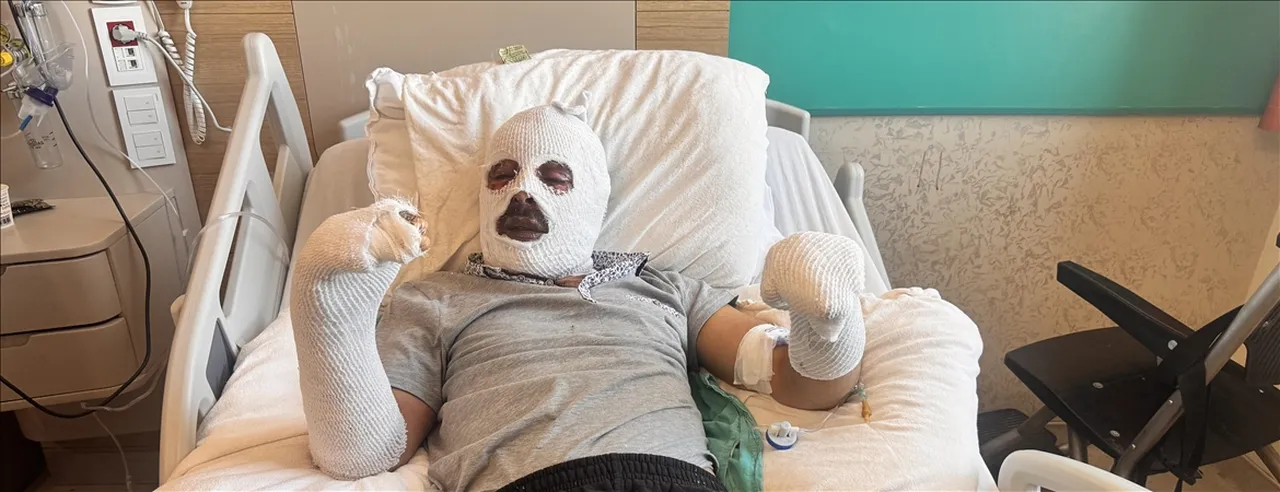 Çay demlerken vücudunun yüzde 26sı yandı!  Ev üstüme yıkıldı