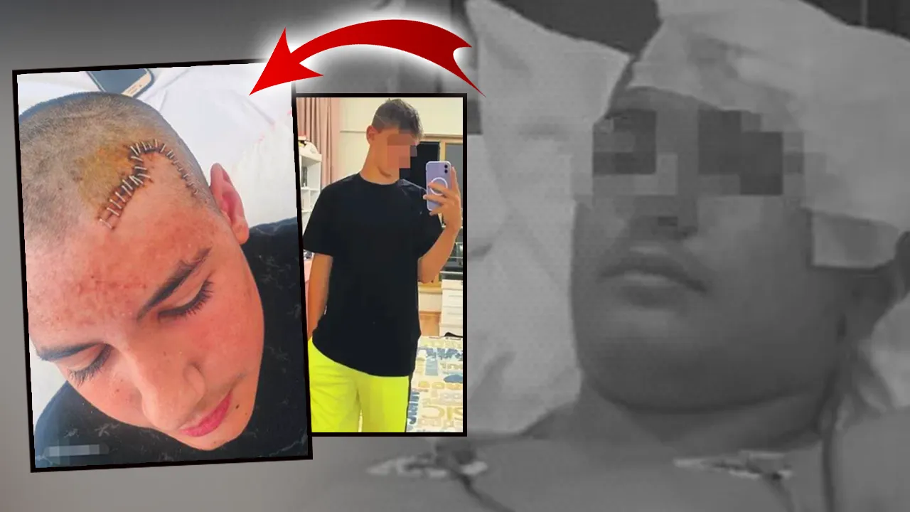 Konya’da kan donduran akran zorbalığı! Taşla vurdu, kafatasını kırdı, beyin zarı yırtıldı 