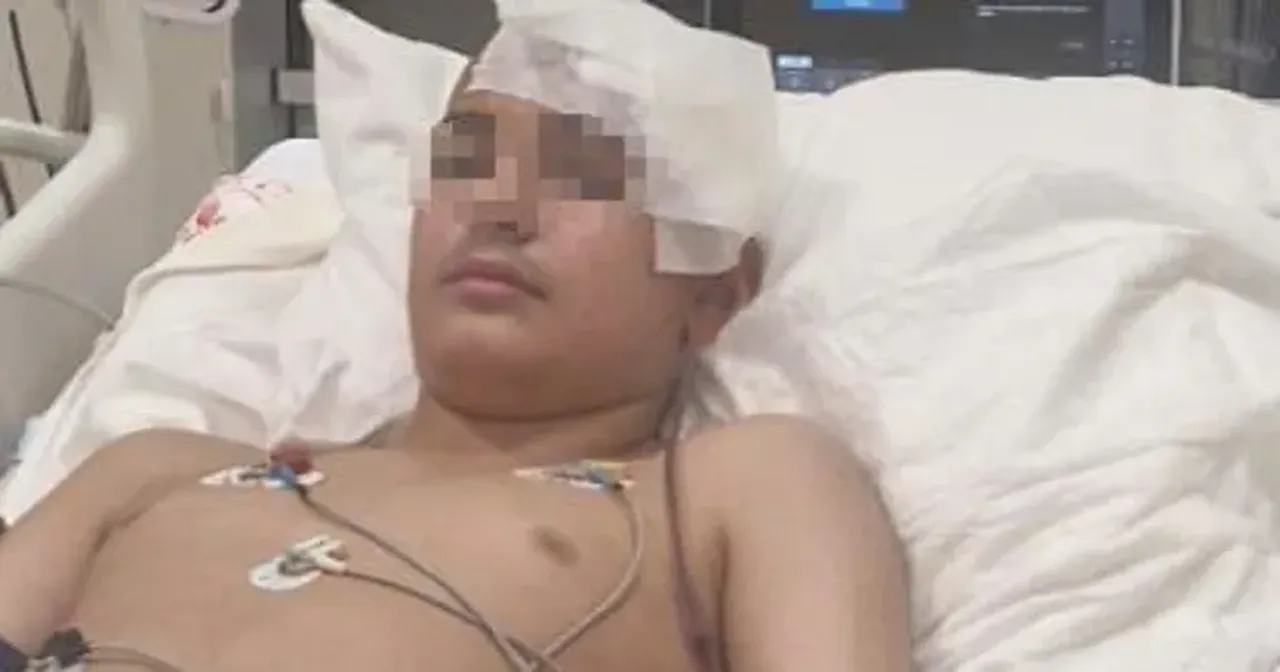 Arkadaşı başına taşla vurdu, kafatası kırıldı