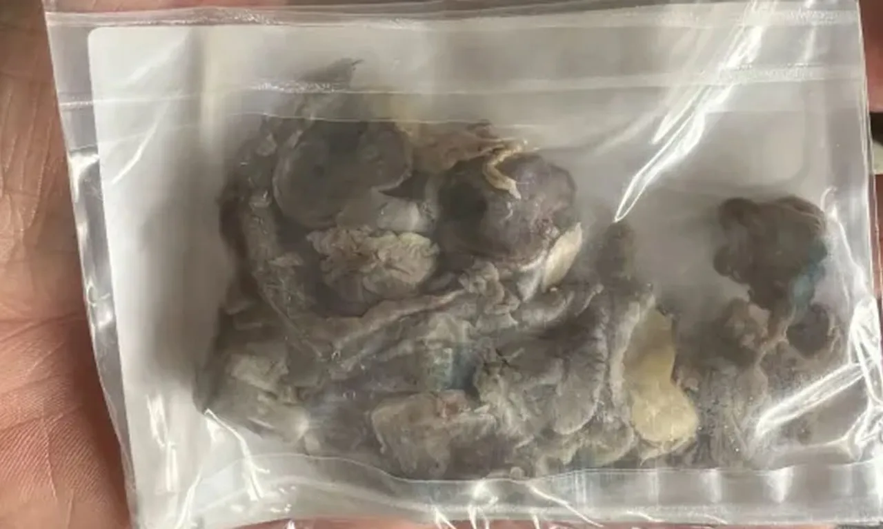 14 yaşında başladı, bedeli ağır oldu! Sönmüş akciğerini görünce hayatının şokunu yaşadı