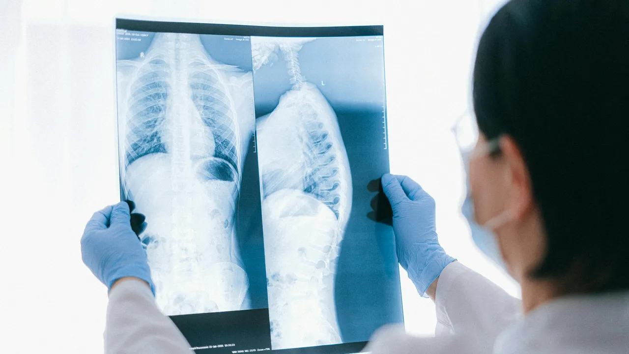 Evinizdeki tehlike airfryer ve tost makinesi! Akciğerlere yapışıp kansere neden oluyor