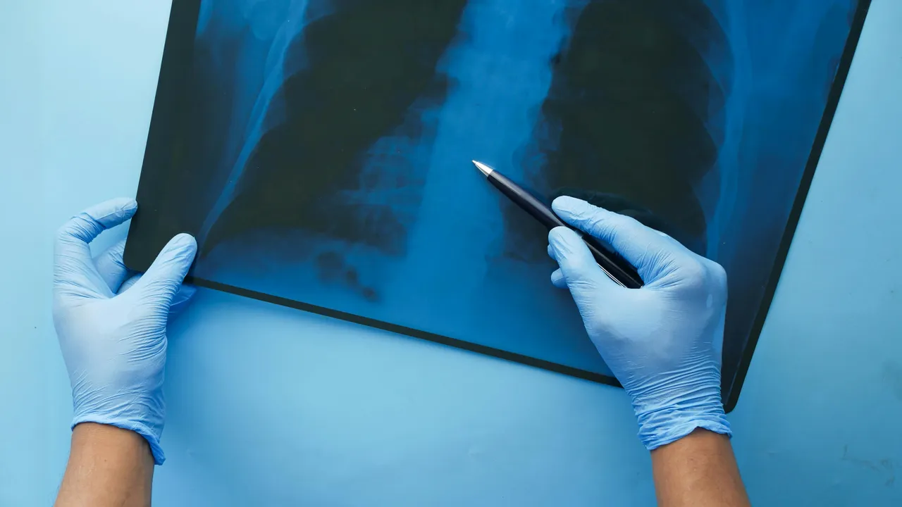 Evinizdeki tehlike airfryer ve tost makinesi! Akciğerlere yapışıp kansere neden oluyor