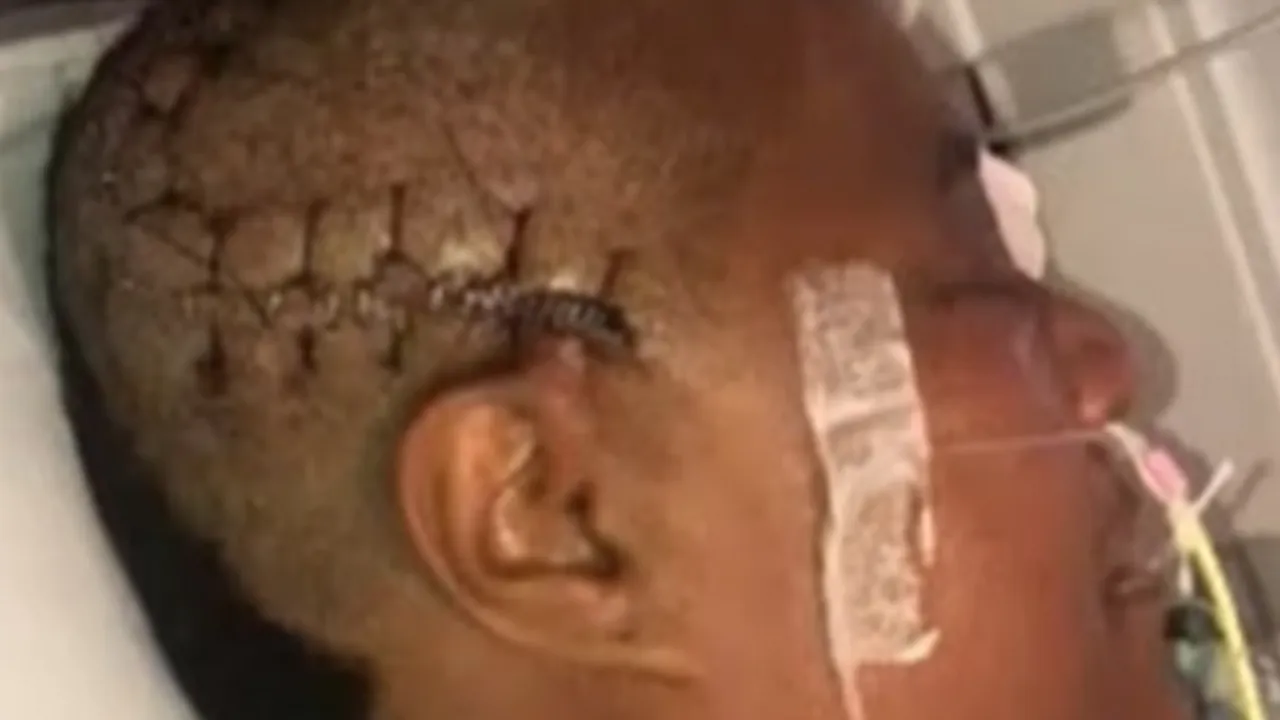 Hastanın kafatasını kaybedip 800 TL teklif ettiler! Kan donduran skandal tıp tarihine geçti