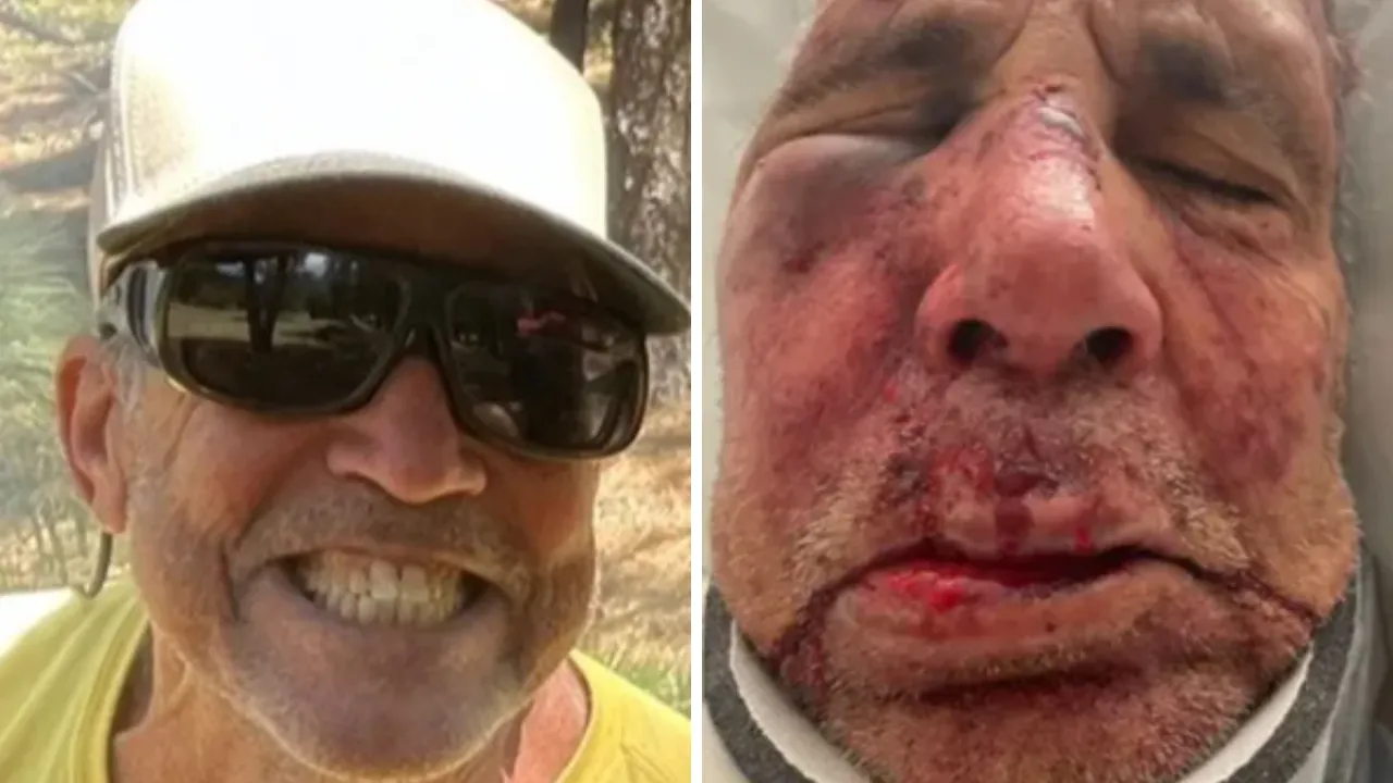 ABD'de sokak ortasında dehşet! Köpeklerini gezdiren yaşlı adam öldüresiye dövüldü