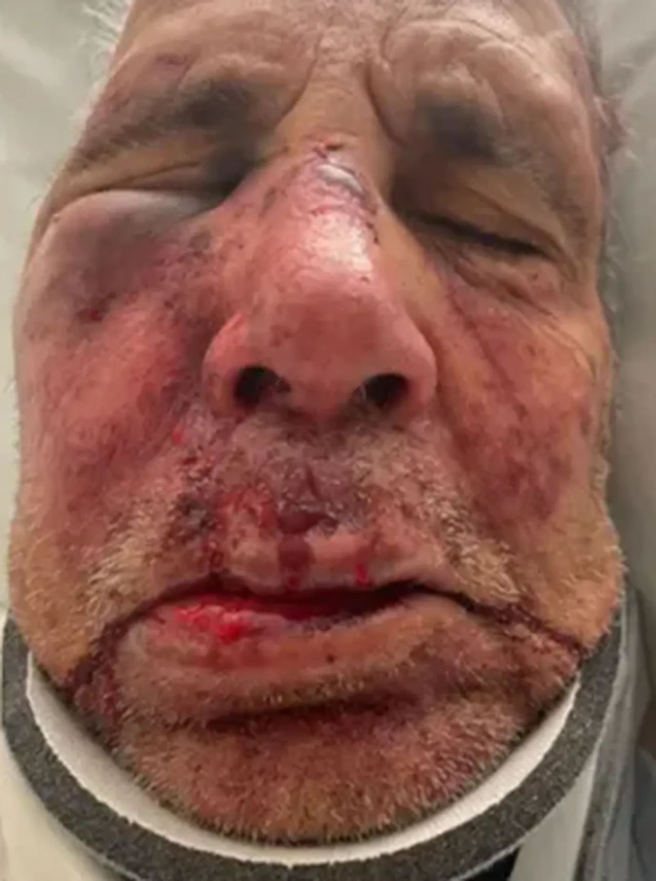 ABDde sokak ortasında dehşet! Köpeklerini gezdiren yaşlı adam öldüresiye dövüldü