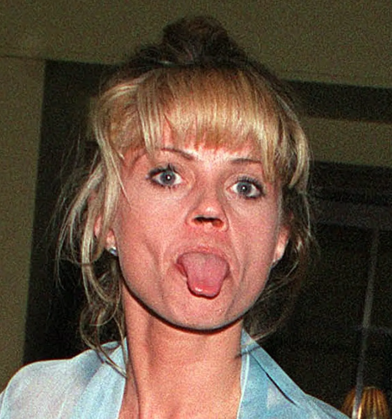 Uyuşturucu bağımlılığı hayatını kabusa çevirdi! Burun kemiği eridi, ağzında delikler açıldı