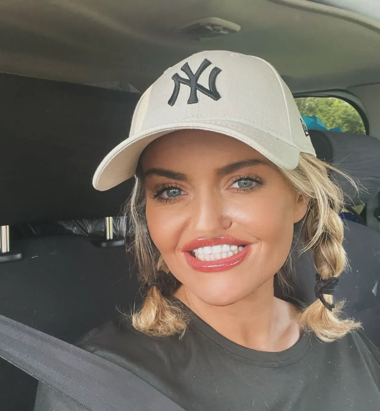 Uyuşturucu bağımlılığı hayatını kabusa çevirdi! Burun kemiği eridi, ağzında delikler açıldı