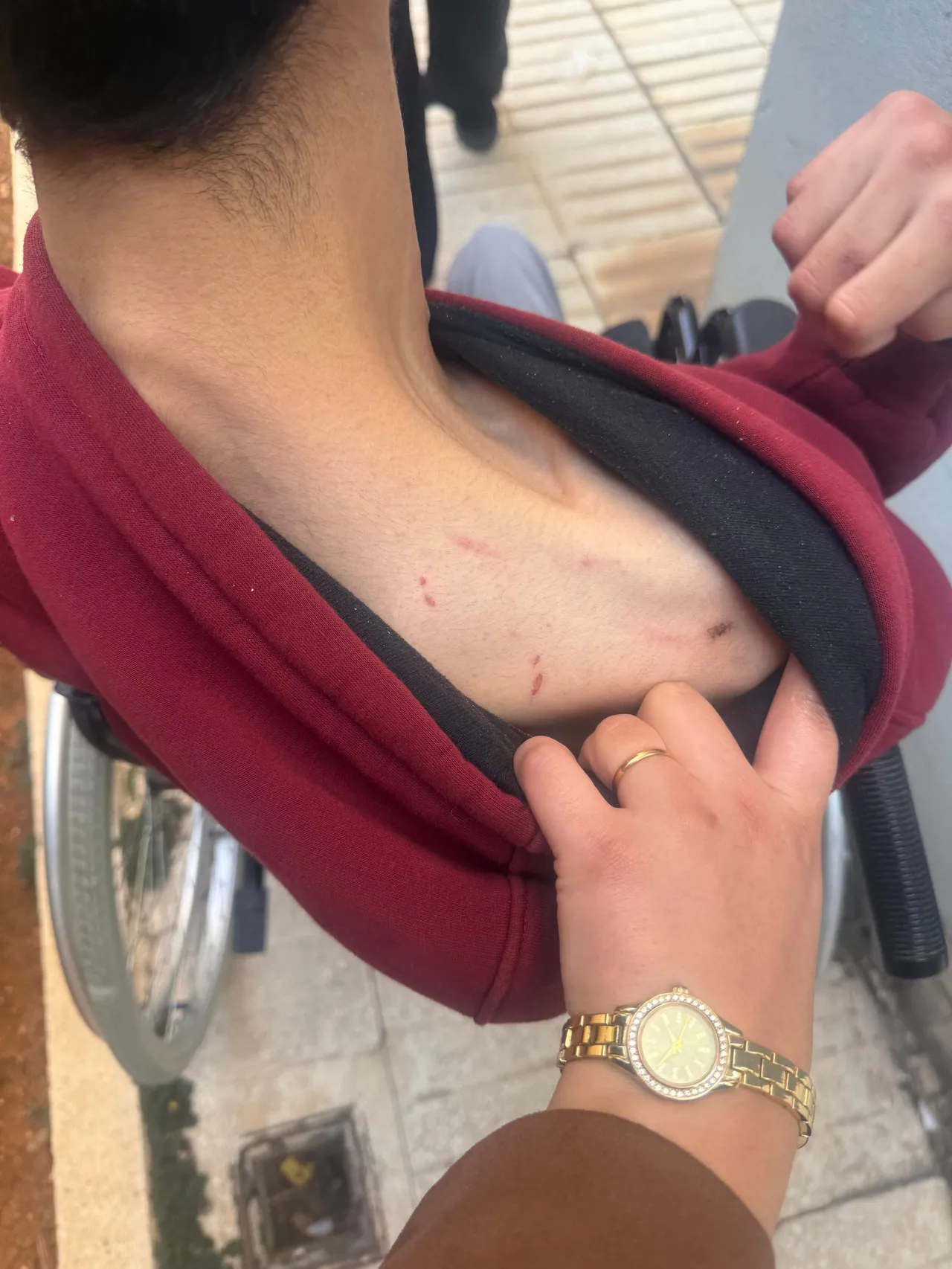 Engelli bakım merkezinde darp skandalı! Aile soluğu savcılıkta aldı