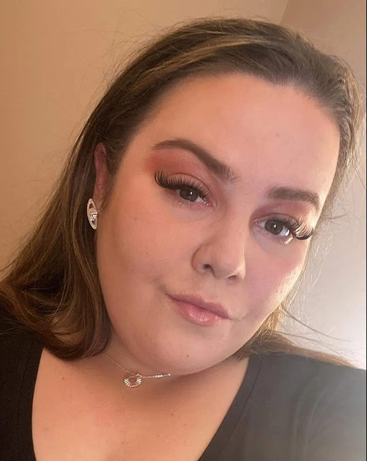 Zayıflama iğnesi kullananlar dikkat! Pankreası iltihaplandı, ölümden döndü: Bedeli ağır oldu