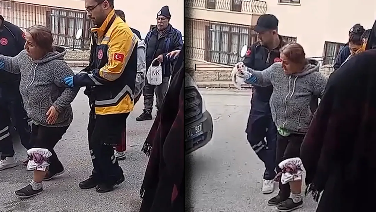 Ankara'da bir kadın 5 köpeğin saldırısına uğradı! Köpeklerin sahibinden tek cümlelik savunma