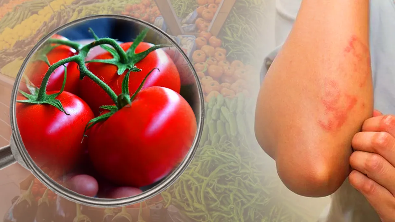 Belirtisi 90 dakikada ortaya çıkan tehlike! Domatesten çikolataya birçok gıdanın içinde var