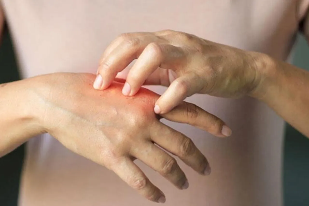 Belirtisi 90 dakikada ortaya çıkan tehlike! Domatesten çikolataya birçok gıdanın içinde var