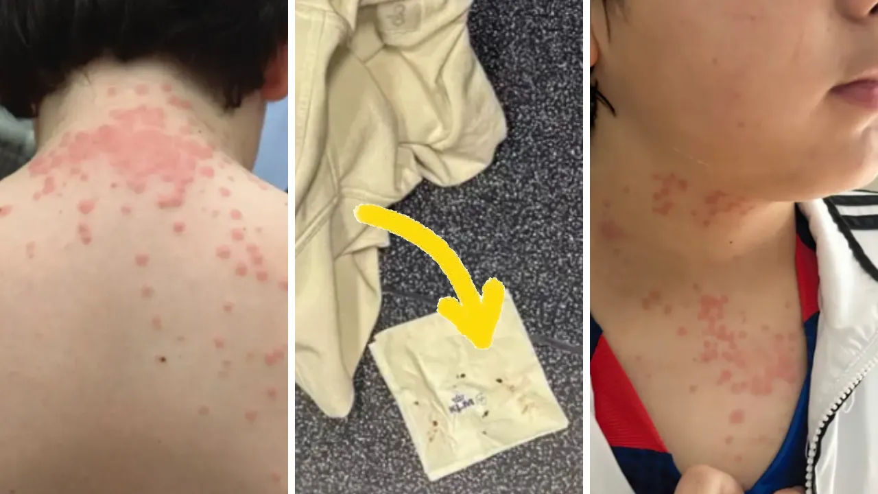 Dev havayolu şirketine 'tahtakurusu' davası! Aile kabusu yaşadı: Üzerimde geziyorlardı