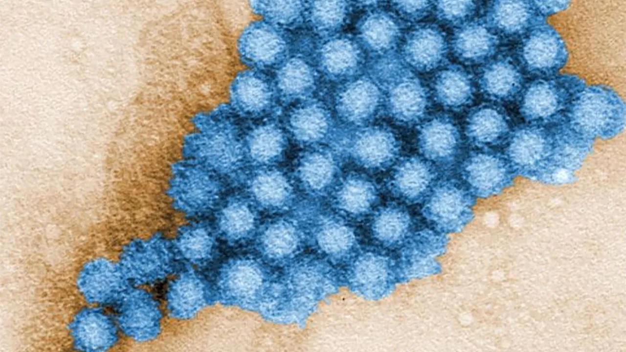 Mide gribi vakaları tavan yaptı: Norovirüs bu kış neden daha tehlikeli? (Norovirüs nedir, belirtileri nelerdir?)