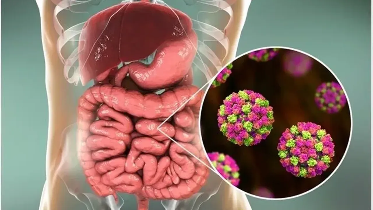 Mide gribi vakaları tavan yaptı: Norovirüs bu kış neden daha tehlikeli? (Norovirüs nedir, belirtileri nelerdir?)