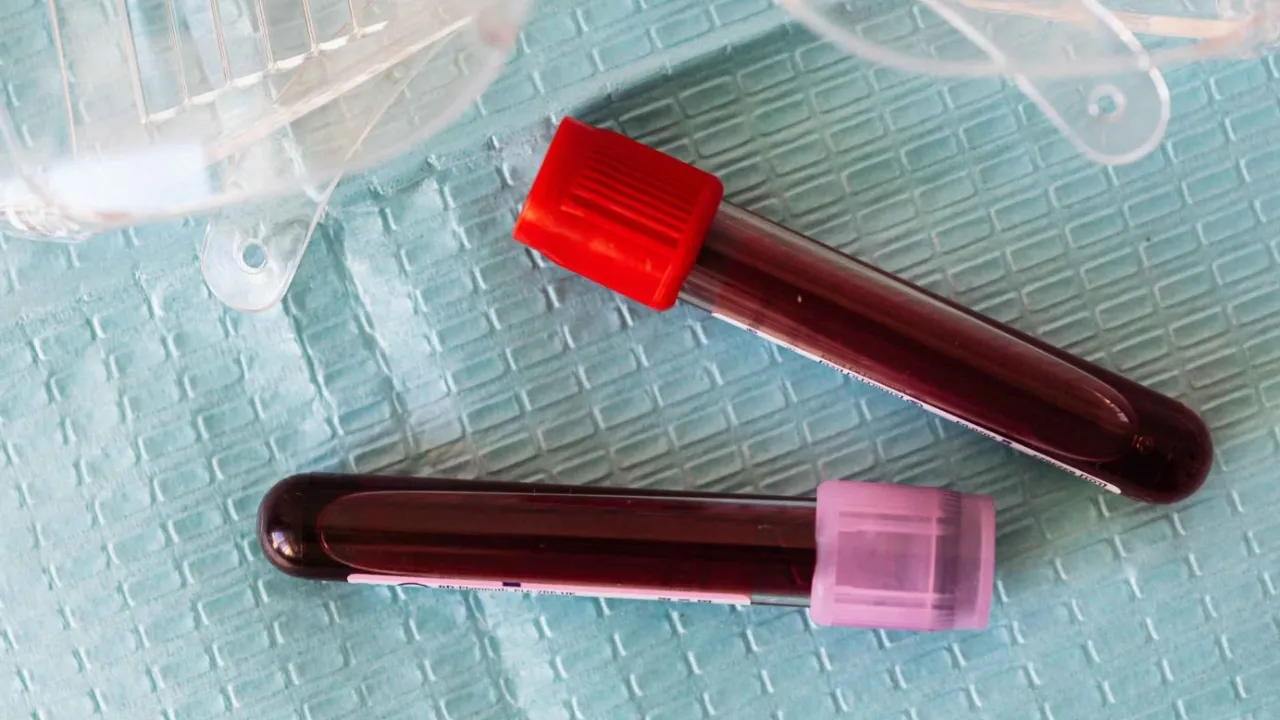 Doktorlar gözlerine inanamadı! Kan testinde iki cinsiyet ortaya çıktı: Uzmanlar uyarıyor