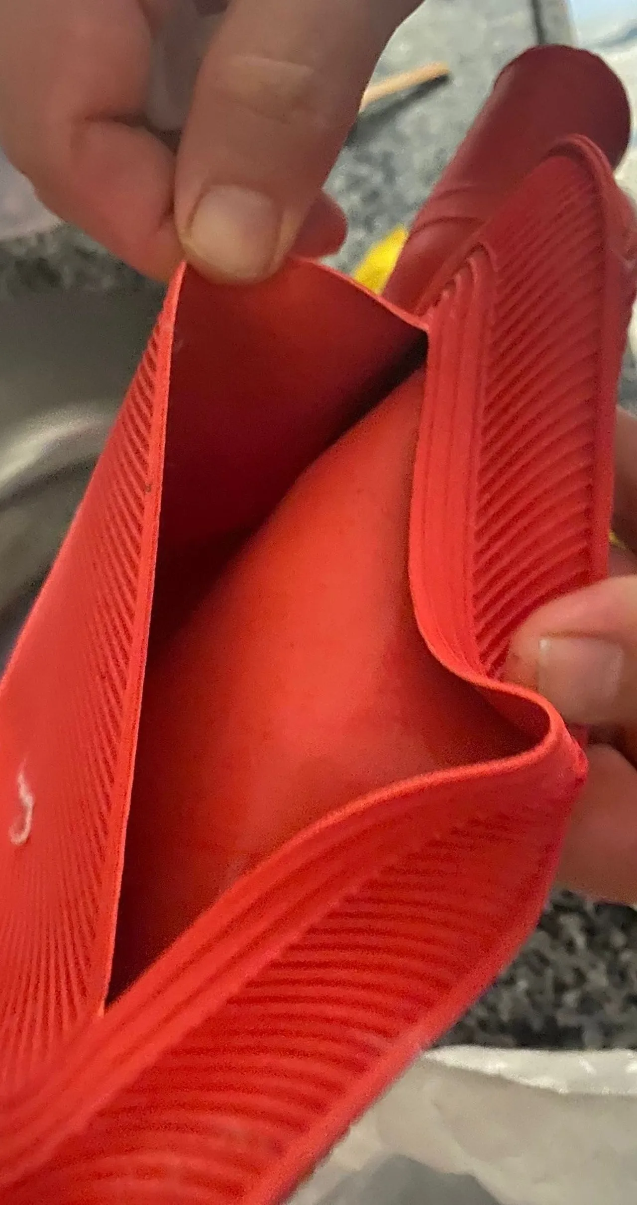 Patlayan sıcak su torbası dehşet saçtı! Vücudunun yüzde 25i yanan genç kız: O acının tarifi yok