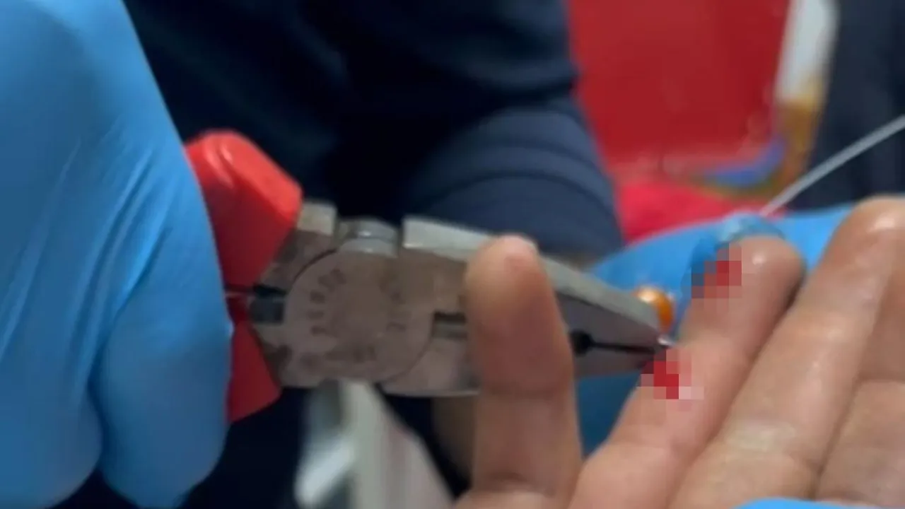 Balık keyfi acilde bitti! Parmağına saplanan iğneyi itfaiye çıkardı