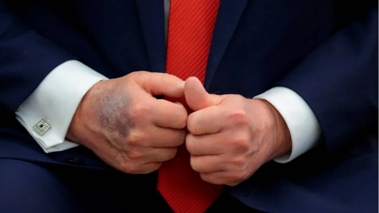 Trump toplantının ortasında uyuyakaldı!  Hasta mı?  sorusu yeniden alevlendi