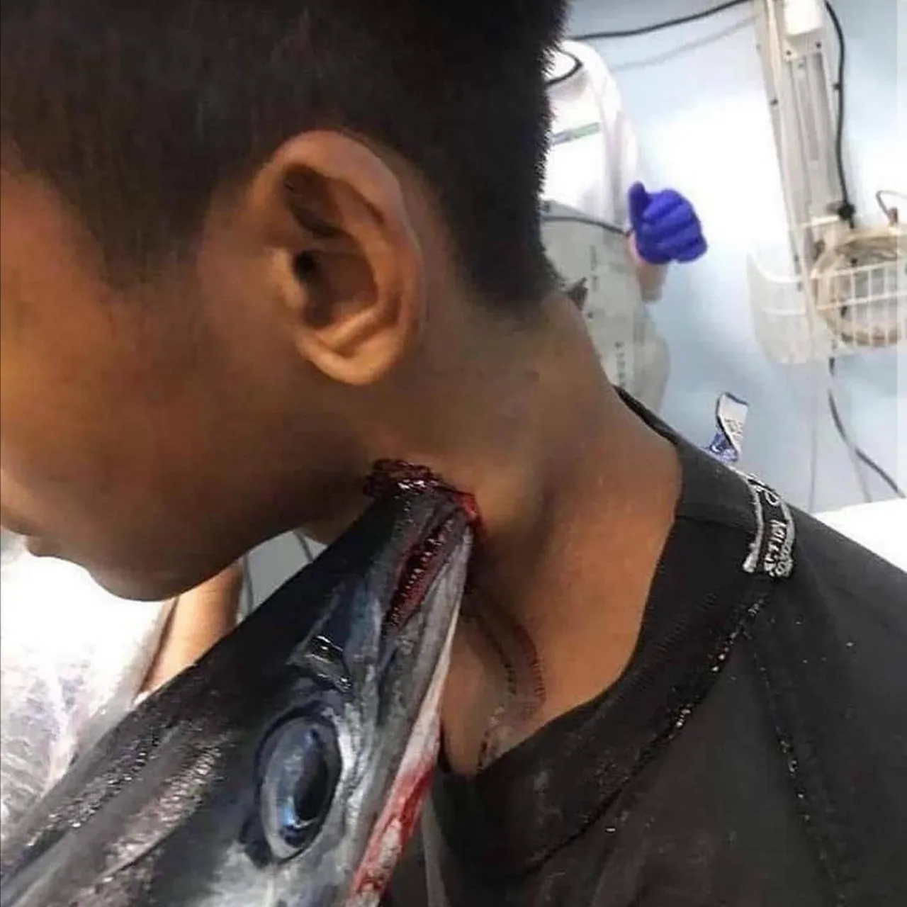 Balık adamı bıçakladı, dişten göz oldu! Dünyanın en sıra dışı vakaları açıklandı